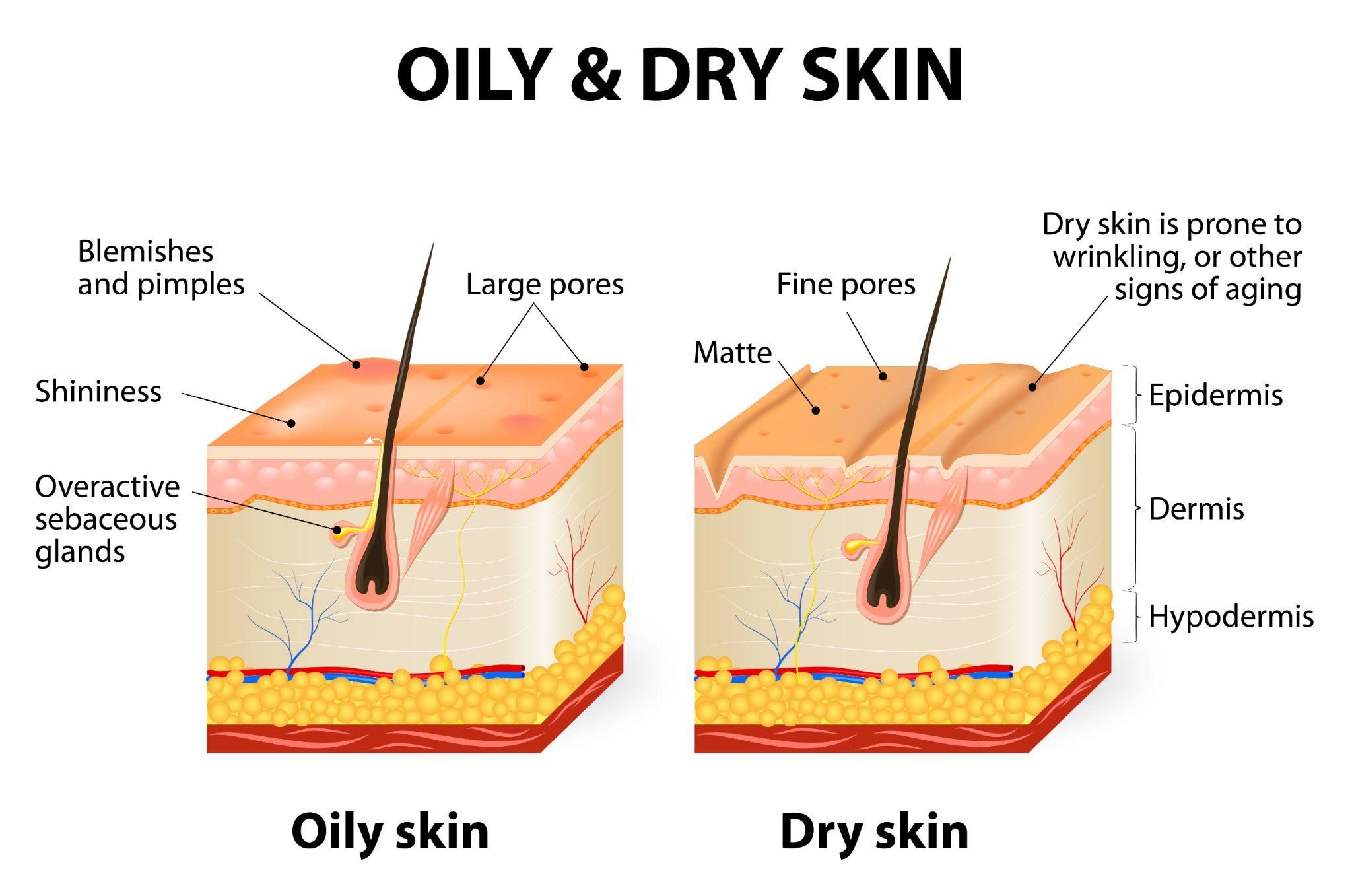 oily skin Blog